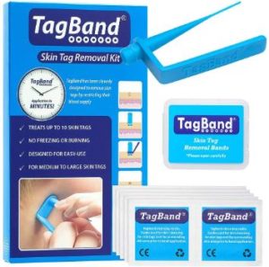 3. TagBand Skin Tag Removal Device