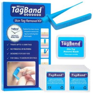 8. Micro TagBand Skin Tag Remover